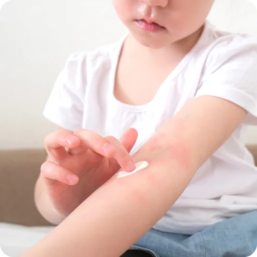 Child scratching an itchy arm