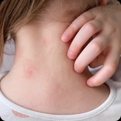 Child scratching a rash on the neck