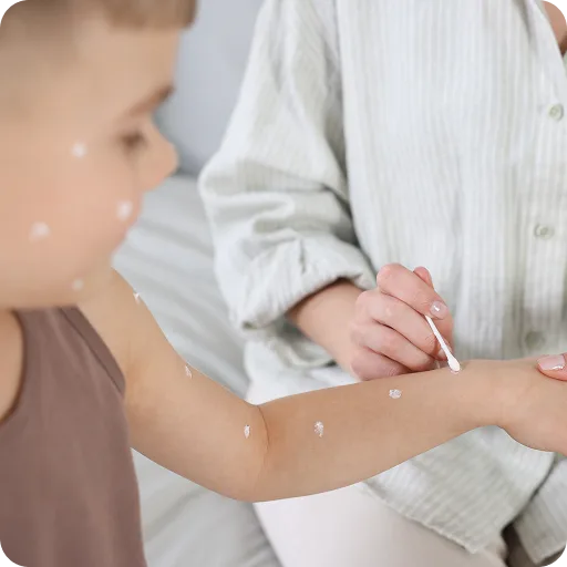 Child's arm with a red rash