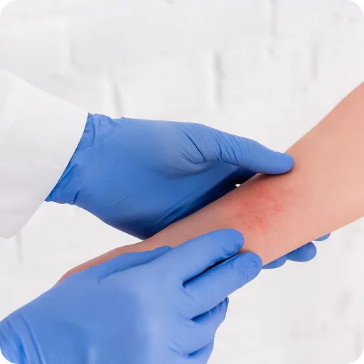 Gloved hands examining a child's arm