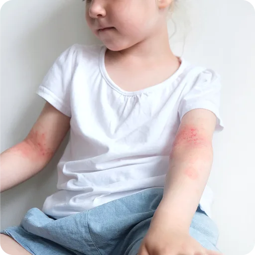 Young child scratching their arm