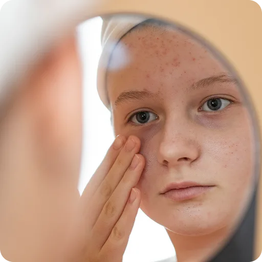 Girl checking her skin in a mirror