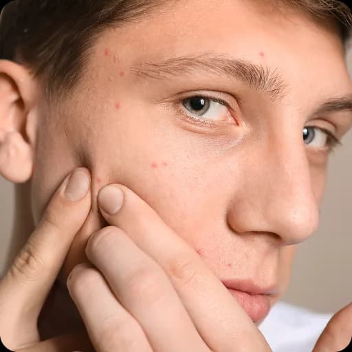 Teenage boy checking a spot on his face