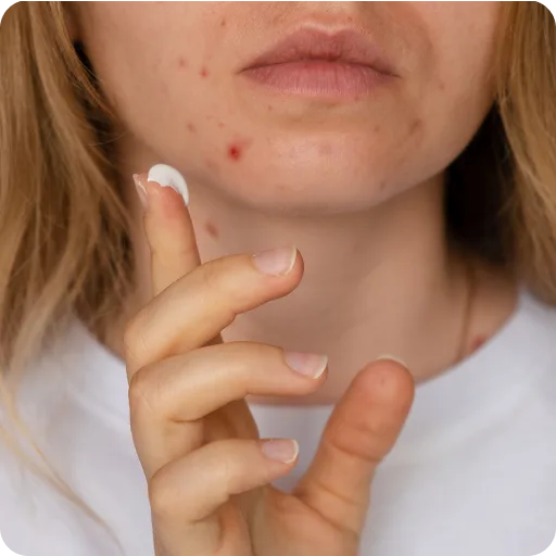 Teenage girl examining a spot on her chin