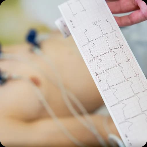Close-up of an ECG trace on paper